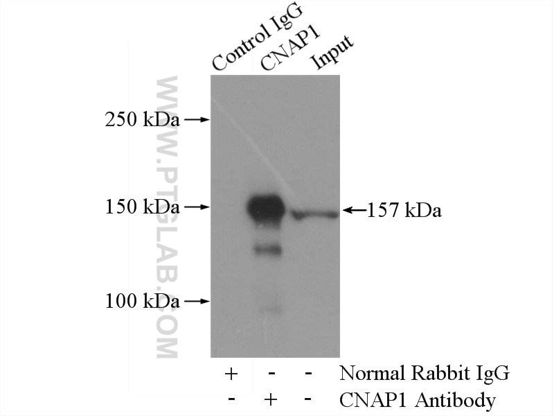 IP experiment of HEK-293 using 13382-1-AP