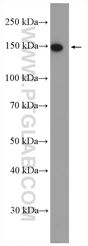 Western Blot (WB) analysis of COLO 320 cells using NCAPD2 Polyclonal antibody (13382-1-AP)