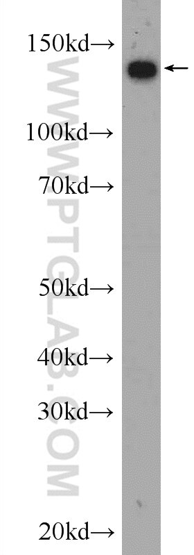 Western Blot (WB) analysis of HEK-293 cells using NCAPD2 Polyclonal antibody (13382-1-AP)