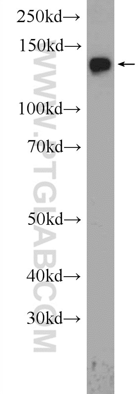 Western Blot (WB) analysis of HeLa cells using NCAPD2 Polyclonal antibody (13382-1-AP)