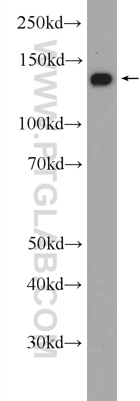 Western Blot (WB) analysis of K-562 cells using NCAPD2 Polyclonal antibody (13382-1-AP)