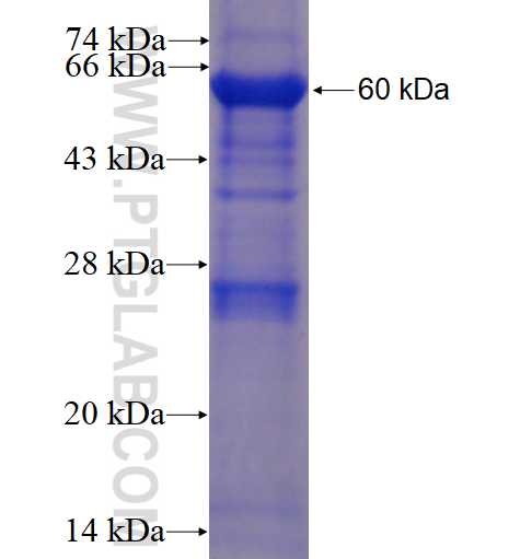 NCAPD2 fusion protein Ag4219 SDS-PAGE