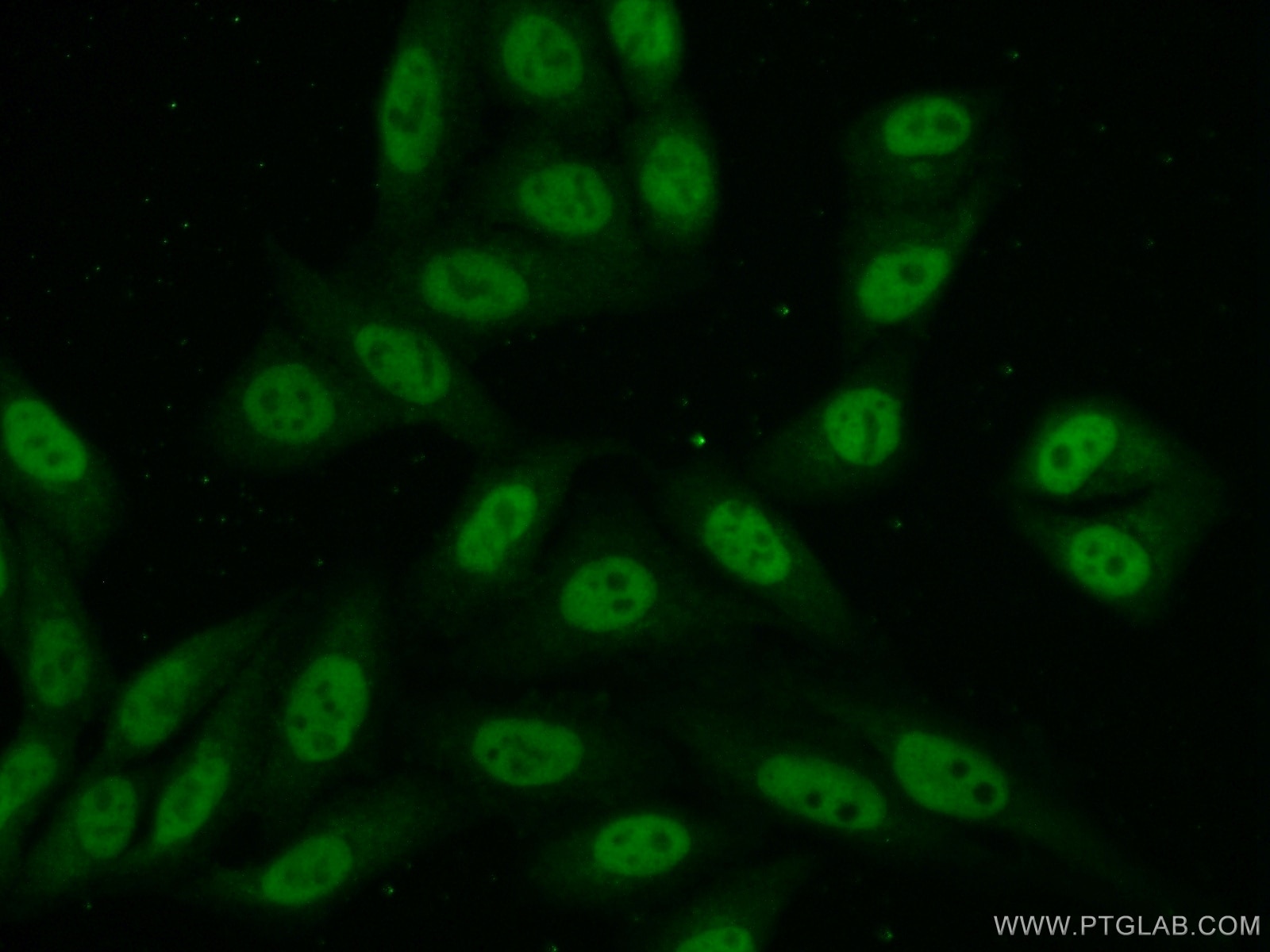 Immunofluorescence (IF) / fluorescent staining of HepG2 cells using NCAPD3 Polyclonal antibody (16828-1-AP)