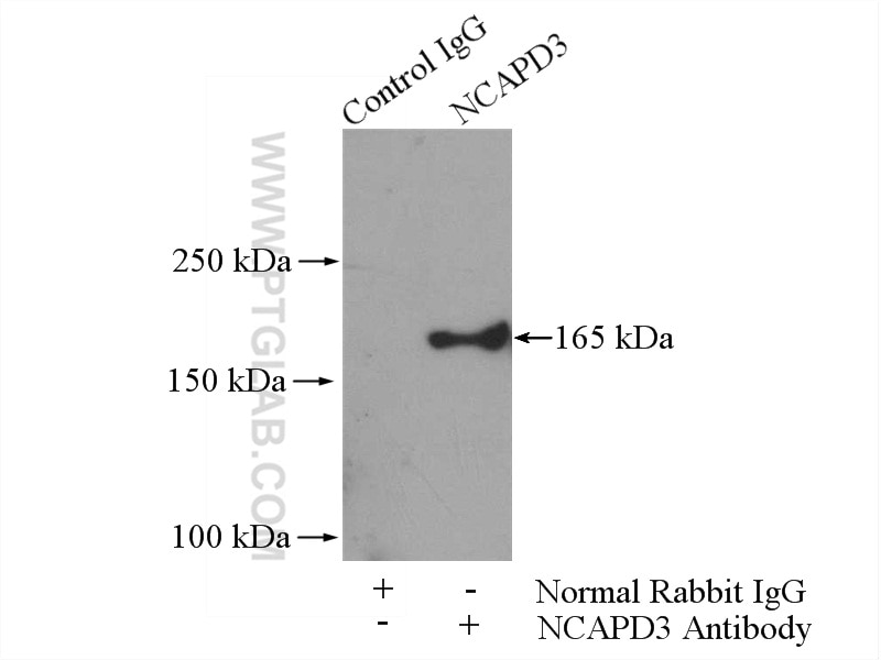 Immunoprecipitation (IP) experiment of HeLa cells using NCAPD3 Polyclonal antibody (16828-1-AP)