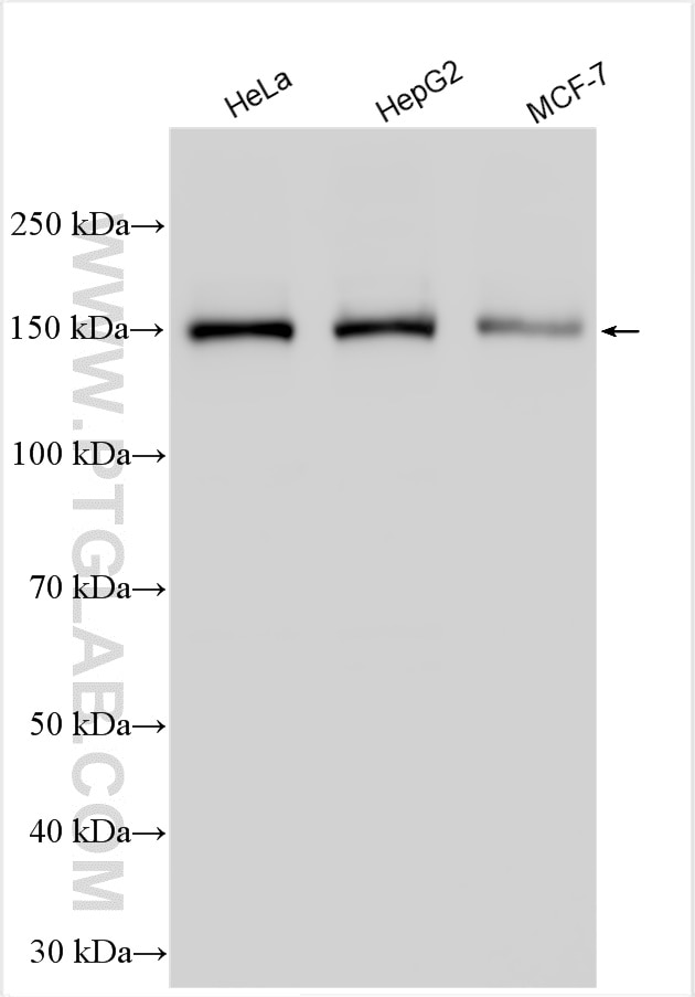 Western Blot (WB) analysis of various lysates using NCAPD3 Polyclonal antibody (16828-1-AP)