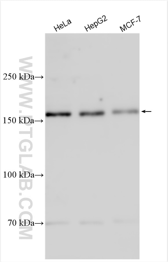 Western Blot (WB) analysis of various lysates using NCAPD3 Polyclonal antibody (16828-1-AP)