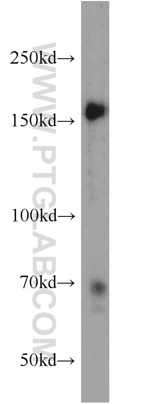 Western Blot (WB) analysis of HeLa cells using NCAPD3 Polyclonal antibody (16828-1-AP)