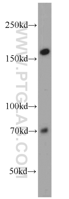 Western Blot (WB) analysis of HepG2 cells using NCAPD3 Polyclonal antibody (16828-1-AP)