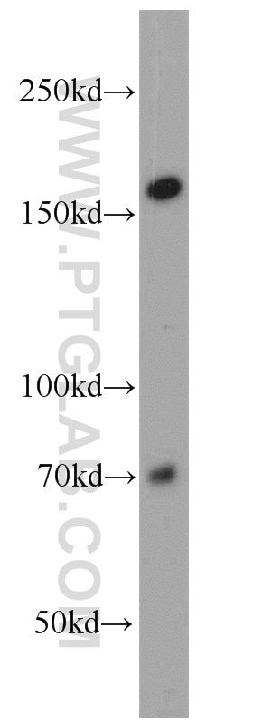 WB analysis of HepG2 using 16828-1-AP