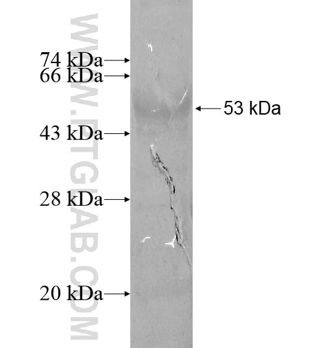 NCAPD3 fusion protein Ag10451 SDS-PAGE