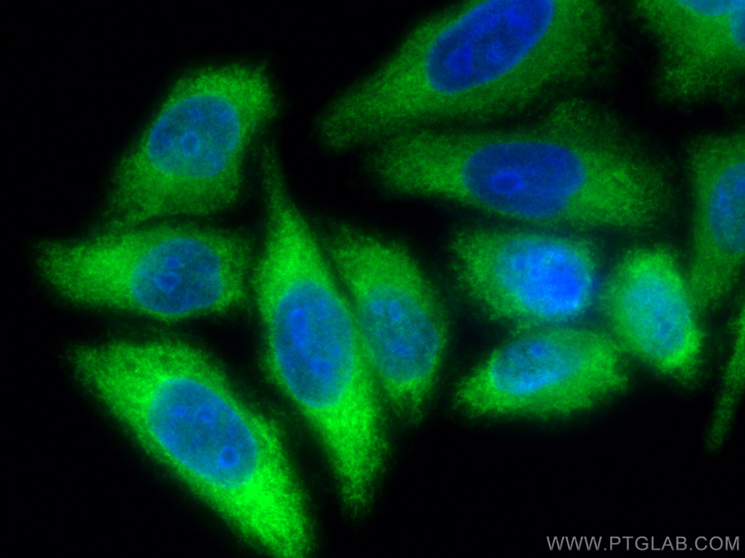 Immunofluorescence (IF) / fluorescent staining of HepG2 cells using NCAPG Polyclonal antibody (24563-1-AP)