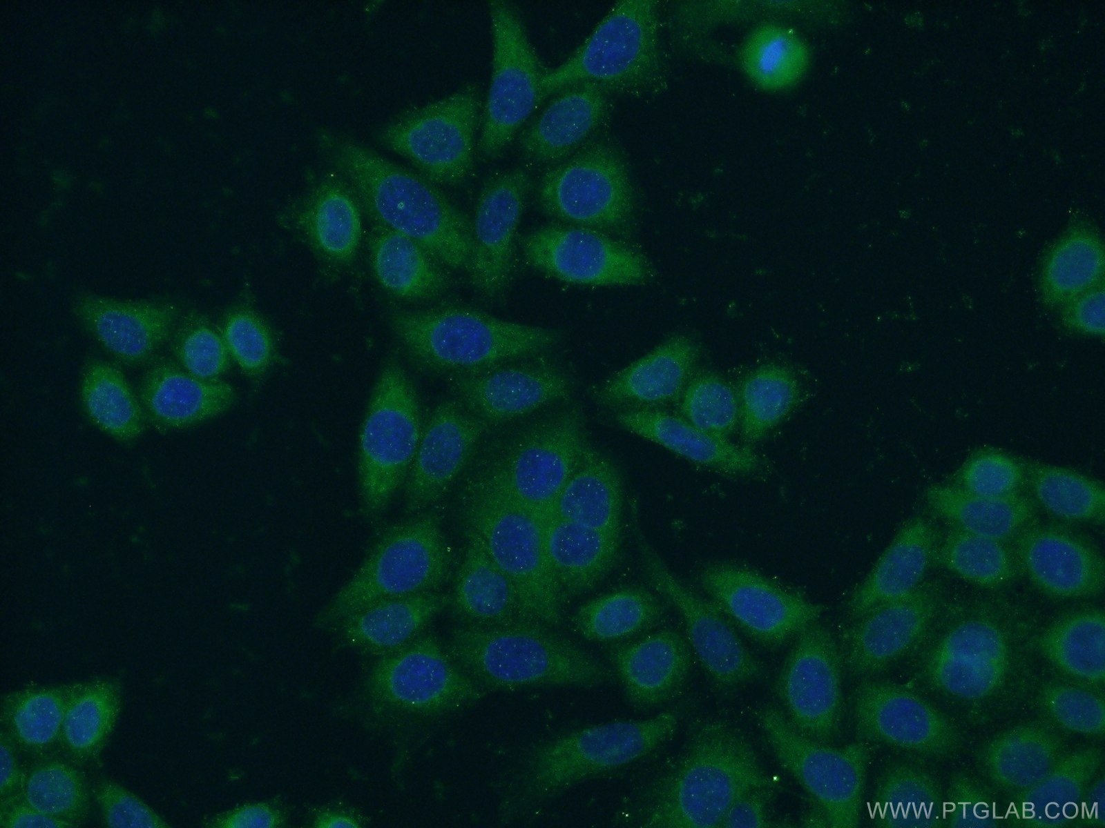 Immunofluorescence (IF) / fluorescent staining of HeLa cells using NCAPG Polyclonal antibody (24563-1-AP)