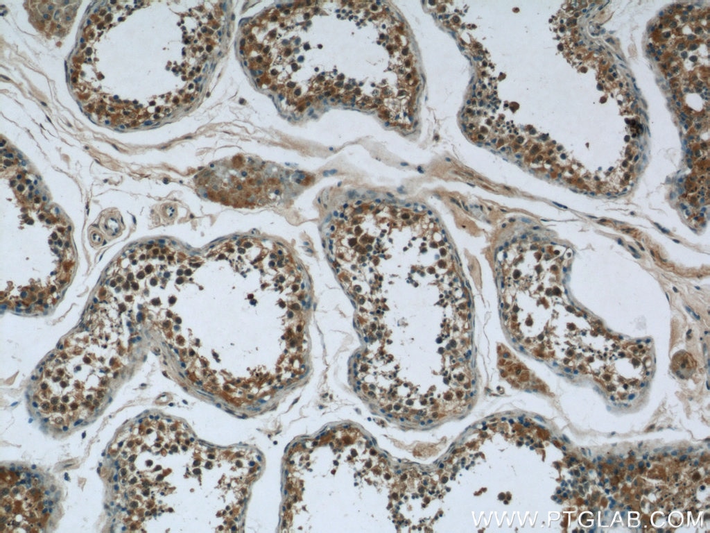 Immunohistochemistry (IHC) staining of human testis tissue using NCAPG Polyclonal antibody (24563-1-AP)