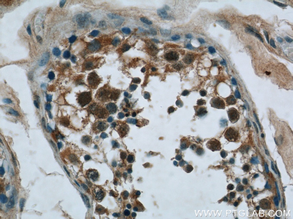 Immunohistochemistry (IHC) staining of human testis tissue using NCAPG Polyclonal antibody (24563-1-AP)