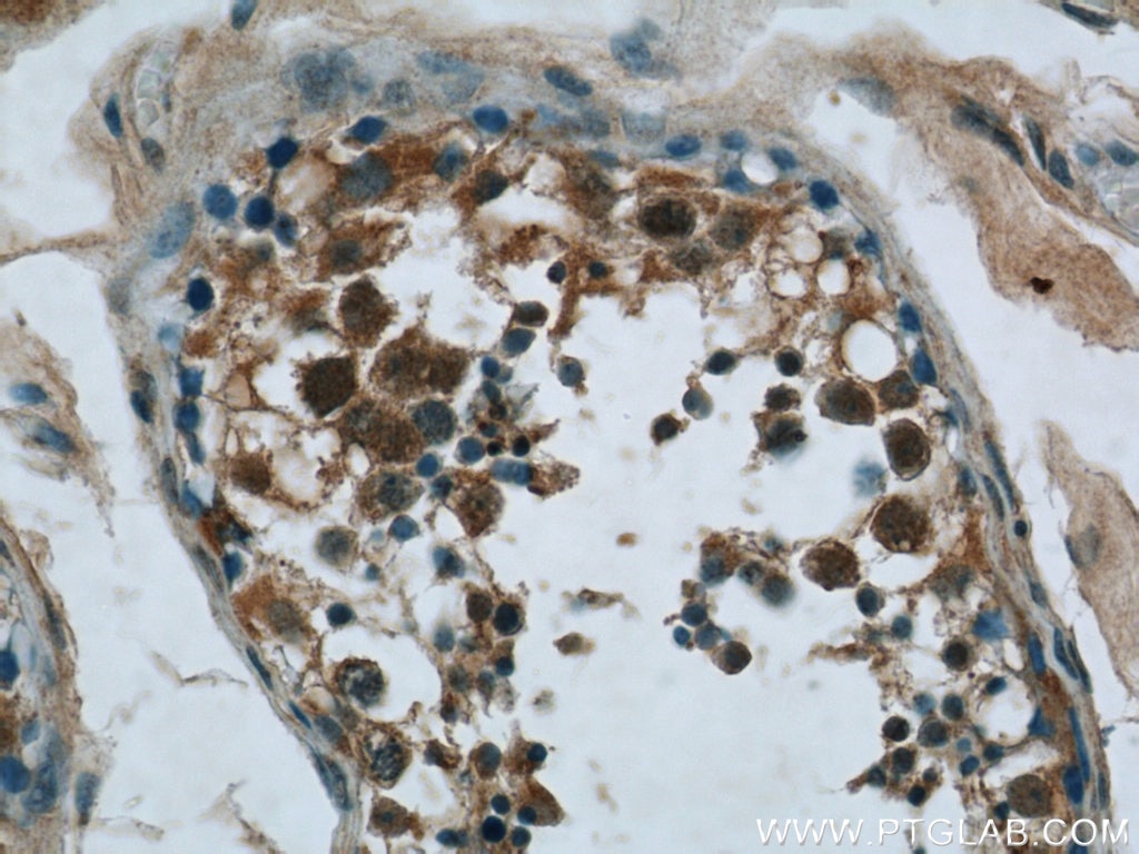 IHC staining of human testis using 24563-1-AP