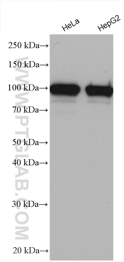 Western Blot (WB) analysis of various lysates using NCAPG Polyclonal antibody (24563-1-AP)