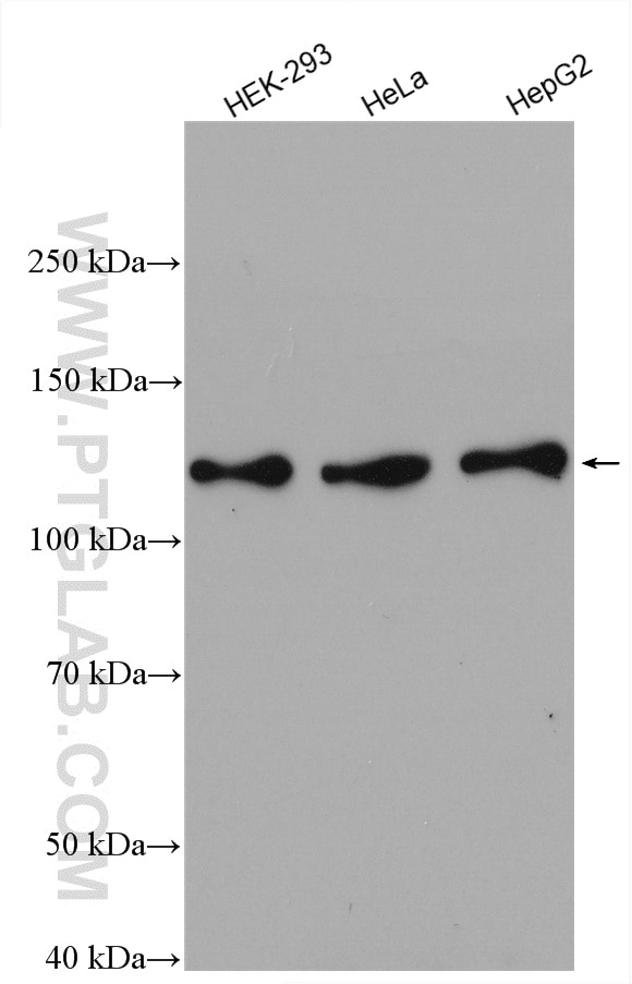 Western Blot (WB) analysis of various lysates using NCAPG Polyclonal antibody (24563-1-AP)