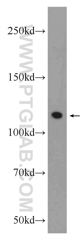 Western Blot (WB) analysis of HEK-293 cells using NCAPG Polyclonal antibody (24563-1-AP)