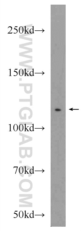 Western Blot (WB) analysis of HeLa cells using NCAPG Polyclonal antibody (24563-1-AP)