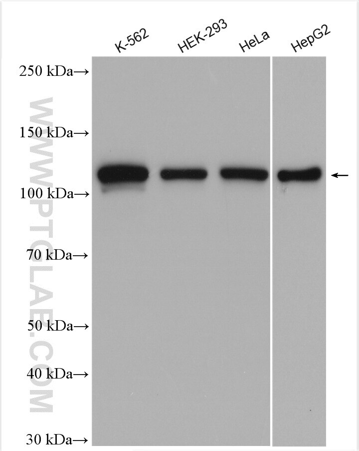 Western Blot (WB) analysis of various lysates using NCAPG Polyclonal antibody (29933-1-AP)