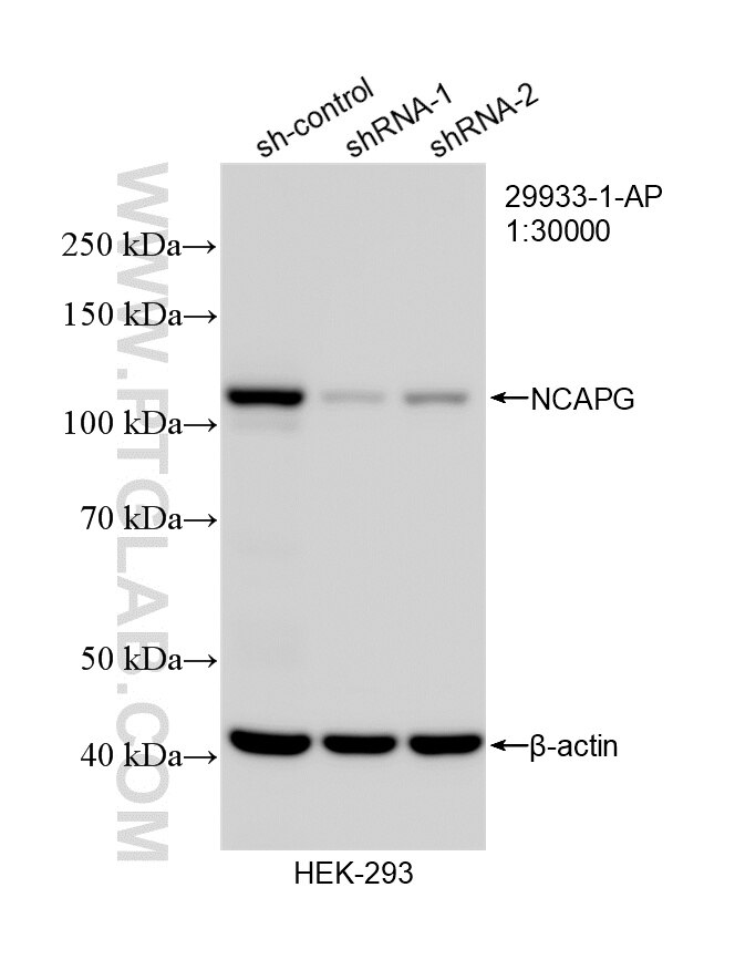 WB result of NCAPG antibody (29933-1-AP; 1:30000; incubated at room temperature for 1.5 hours) with sh-Control and sh-NCAPG transfected HEK-293 cells. Western Blot (WB) analysis of HEK-293 cells using NCAPG Polyclonal antibody (29933-1-AP)