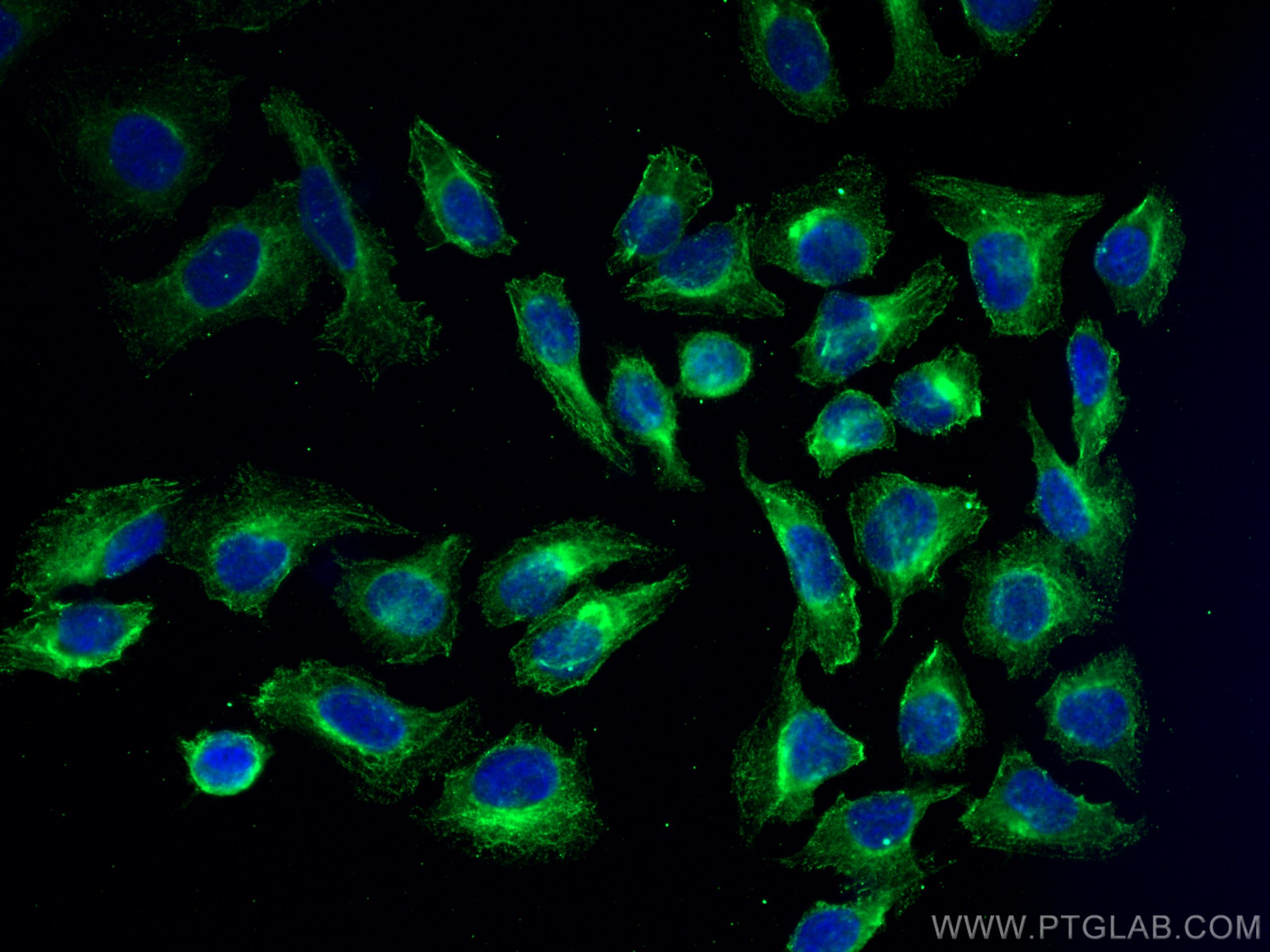 Immunofluorescence (IF) / fluorescent staining of U2OS cells using NCAPG Monoclonal antibody (68082-1-Ig)