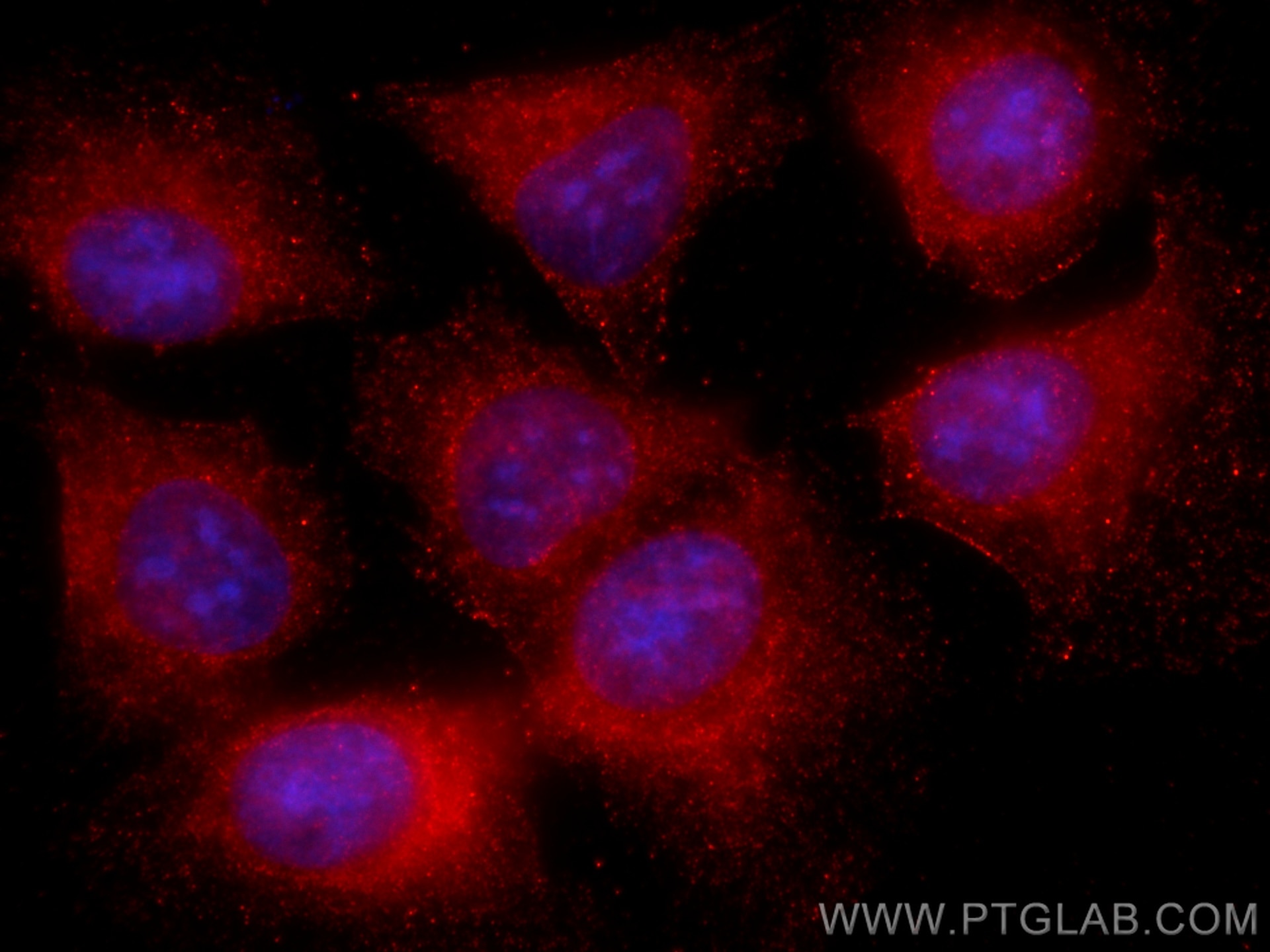 Immunofluorescence (IF) / fluorescent staining of U2OS cells using CoraLite®594-conjugated NCAPG Monoclonal antibody (CL594-68082)