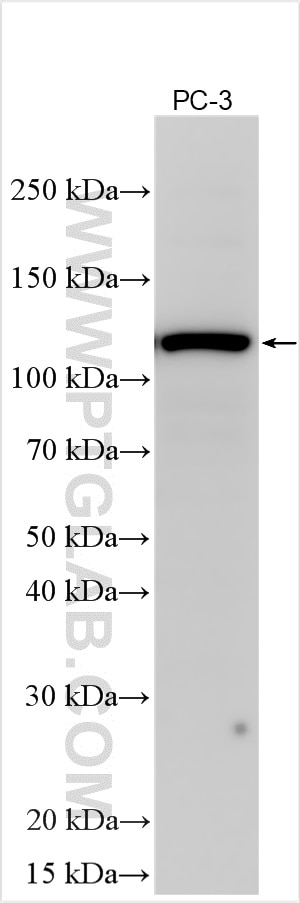 Western Blot (WB) analysis of various lysates using NCAPG2 Polyclonal antibody (32220-1-AP)