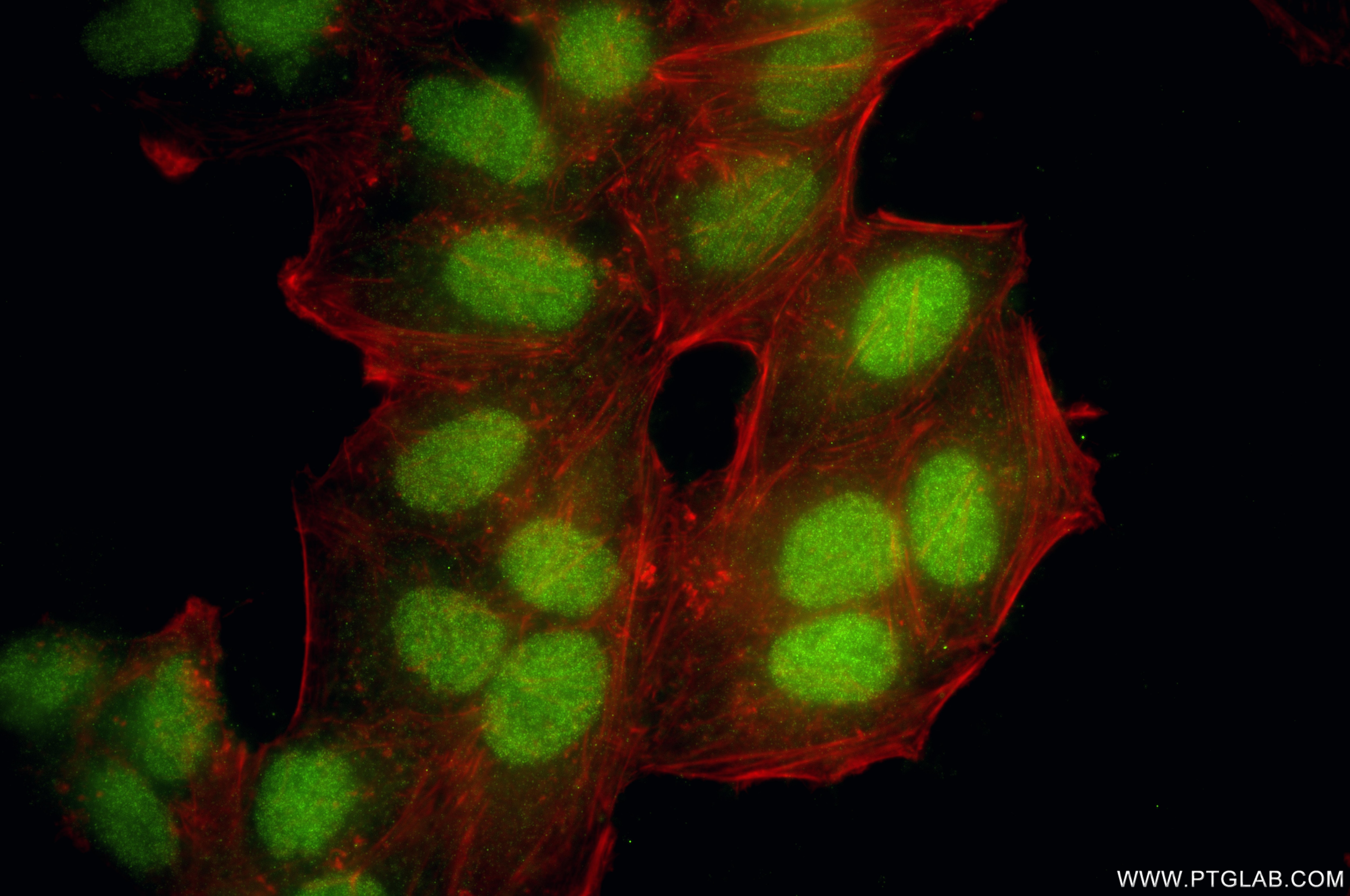 IF Staining of HepG2 using 87645-1-RR Immunofluorescence (IF) / fluorescent staining of HepG2 cells using NCAPG2 Recombinant monoclonal antibody (87645-1-RR)