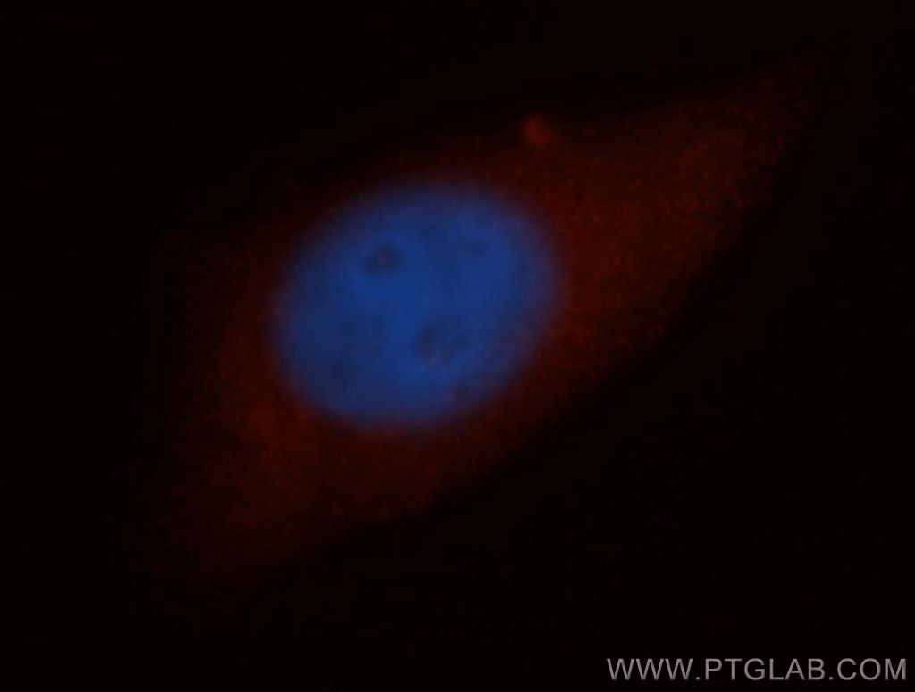 Immunofluorescence (IF) / fluorescent staining of HepG2 cells using NCAPH Polyclonal antibody (11515-1-AP)