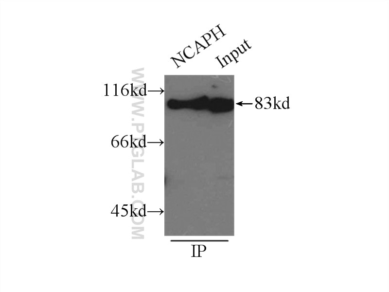 Immunoprecipitation (IP) experiment of HeLa cells using NCAPH Polyclonal antibody (11515-1-AP)