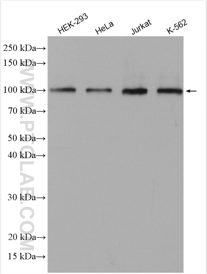 Western Blot (WB) analysis of various lysates using NCAPH Polyclonal antibody (11515-1-AP)