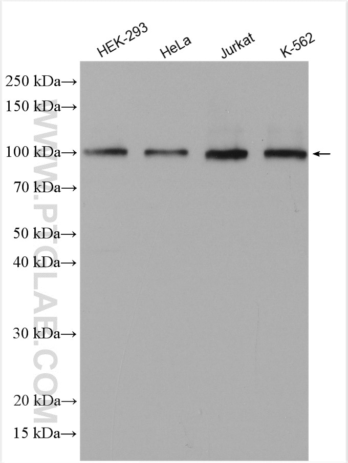 WB analysis using 11515-1-AP