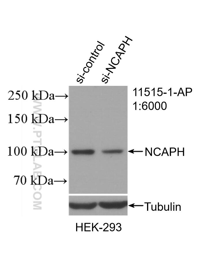 Western Blot (WB) analysis of HEK-293 cells using NCAPH Polyclonal antibody (11515-1-AP)