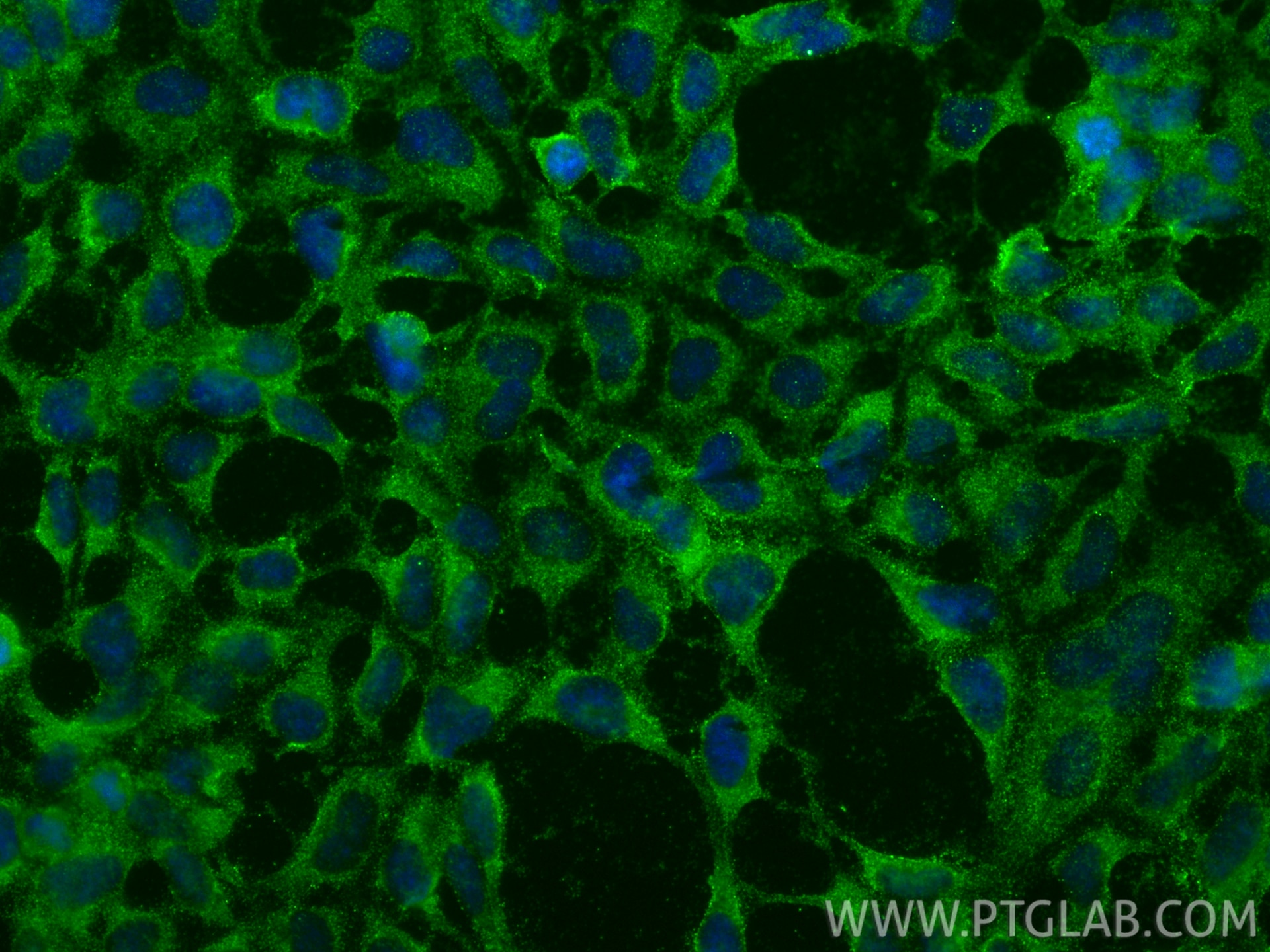 IF Staining of HEK-293 using 67655-1-Ig Immunofluorescence (IF) / fluorescent staining of HEK-293 cells using NCAPH Monoclonal antibody (67655-1-Ig)