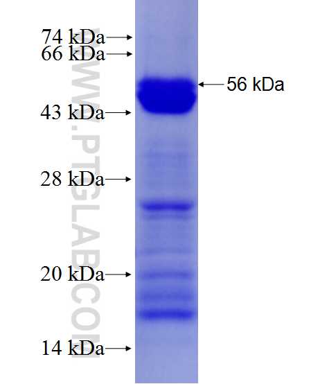 NCAPH fusion protein Ag27748 SDS-PAGE