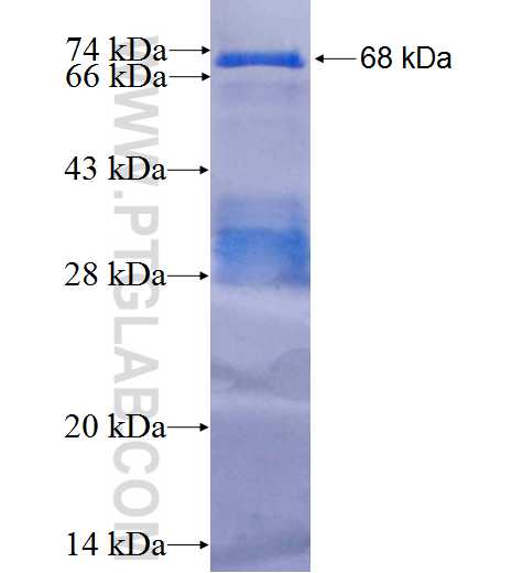 NCAPH fusion protein Ag2076 SDS-PAGE