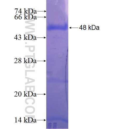 NCAPH2 fusion protein Ag23134 SDS-PAGE