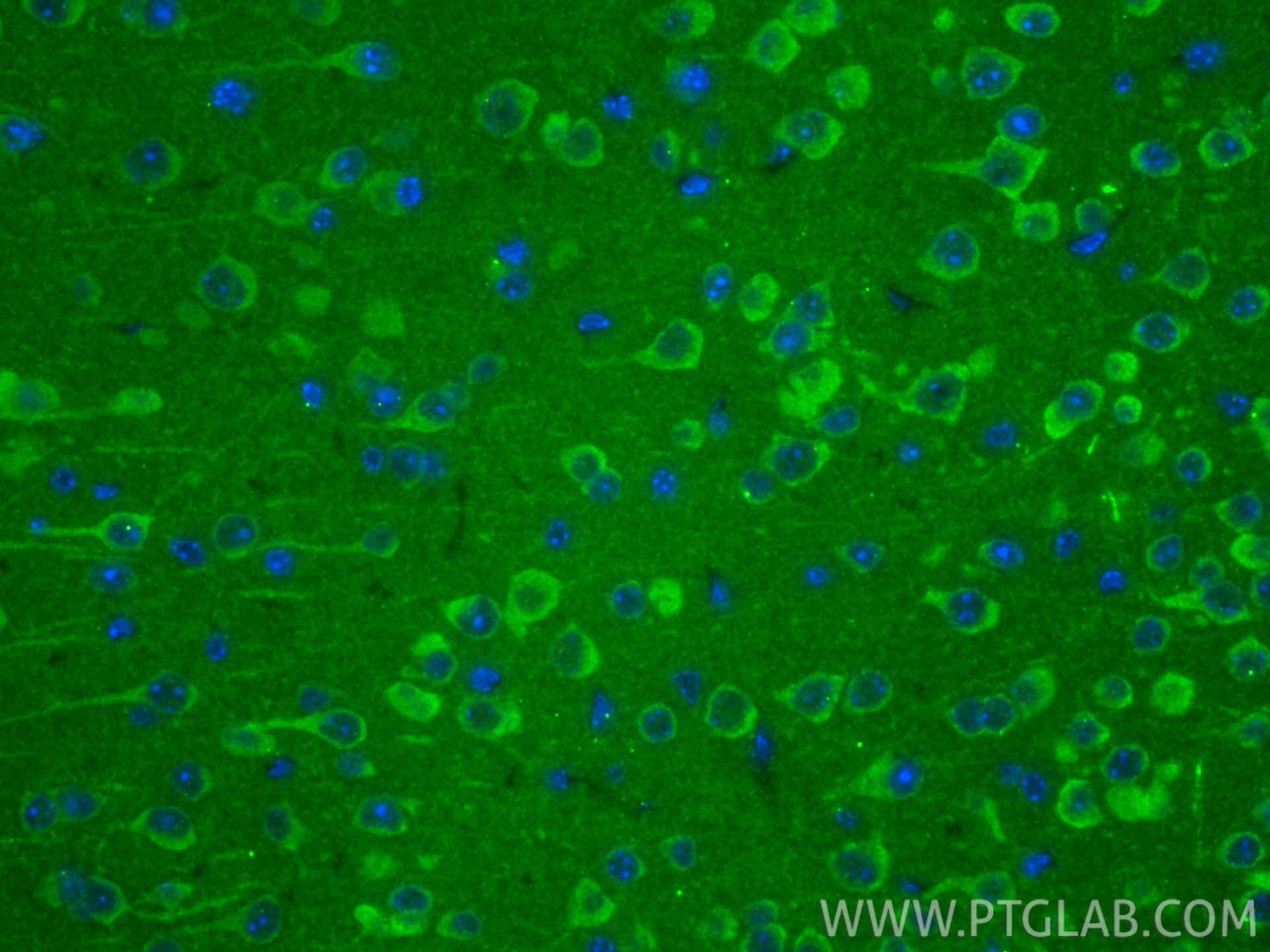 IF Staining of mouse brain using 13187-1-AP Immunofluorescence (IF) / fluorescent staining of mouse brain tissue using Neurochondrin Polyclonal antibody (13187-1-AP)