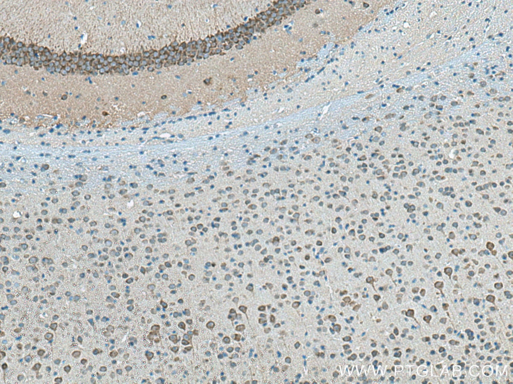 IHC staining of mouse brain using 13187-1-AP