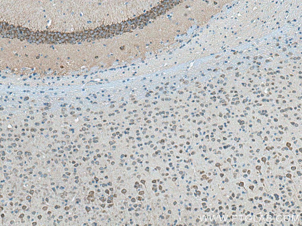 Immunohistochemistry (IHC) staining of mouse brain tissue using Neurochondrin Polyclonal antibody (13187-1-AP)