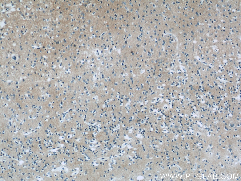Immunohistochemistry (IHC) staining of human brain tissue using Neurochondrin Polyclonal antibody (13187-1-AP)