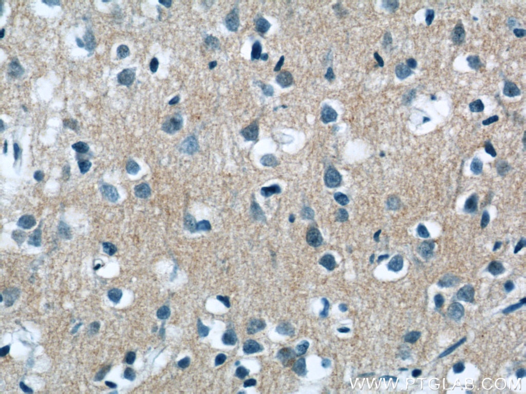 Immunohistochemistry (IHC) staining of human brain tissue using Neurochondrin Polyclonal antibody (13187-1-AP)