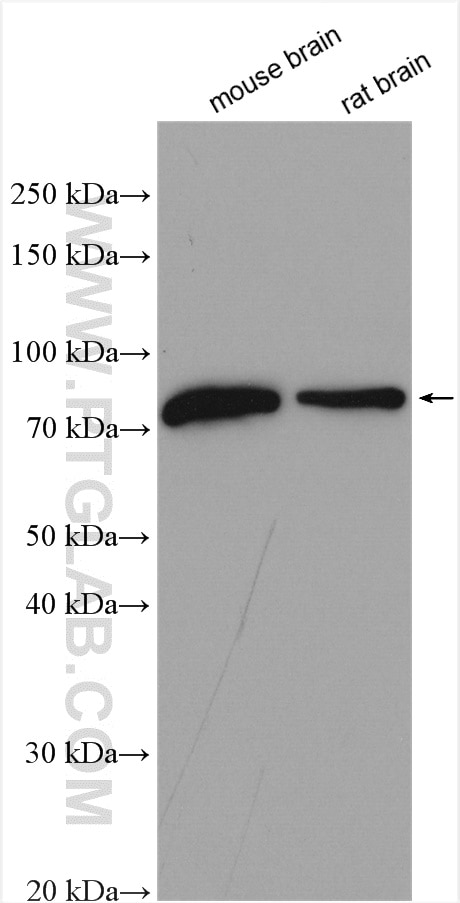 Western Blot (WB) analysis of various lysates using Neurochondrin Polyclonal antibody (13187-1-AP)