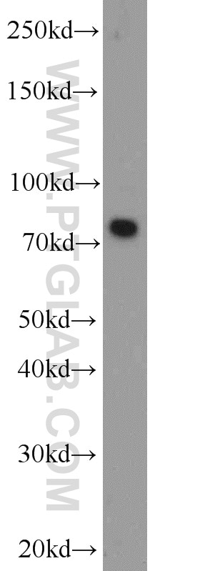 Western Blot (WB) analysis of mouse brain tissue using Neurochondrin Polyclonal antibody (13187-1-AP)