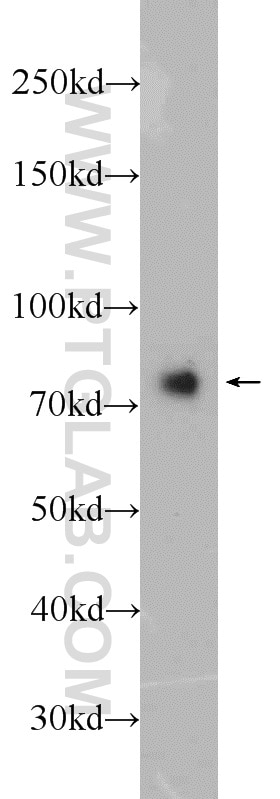 Western Blot (WB) analysis of rat brain tissue using Neurochondrin Polyclonal antibody (13187-1-AP)