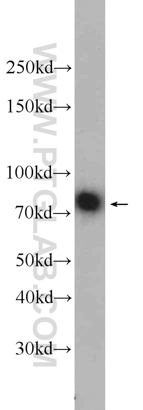 Western Blot (WB) analysis of human brain tissue using Neurochondrin Polyclonal antibody (13187-1-AP)