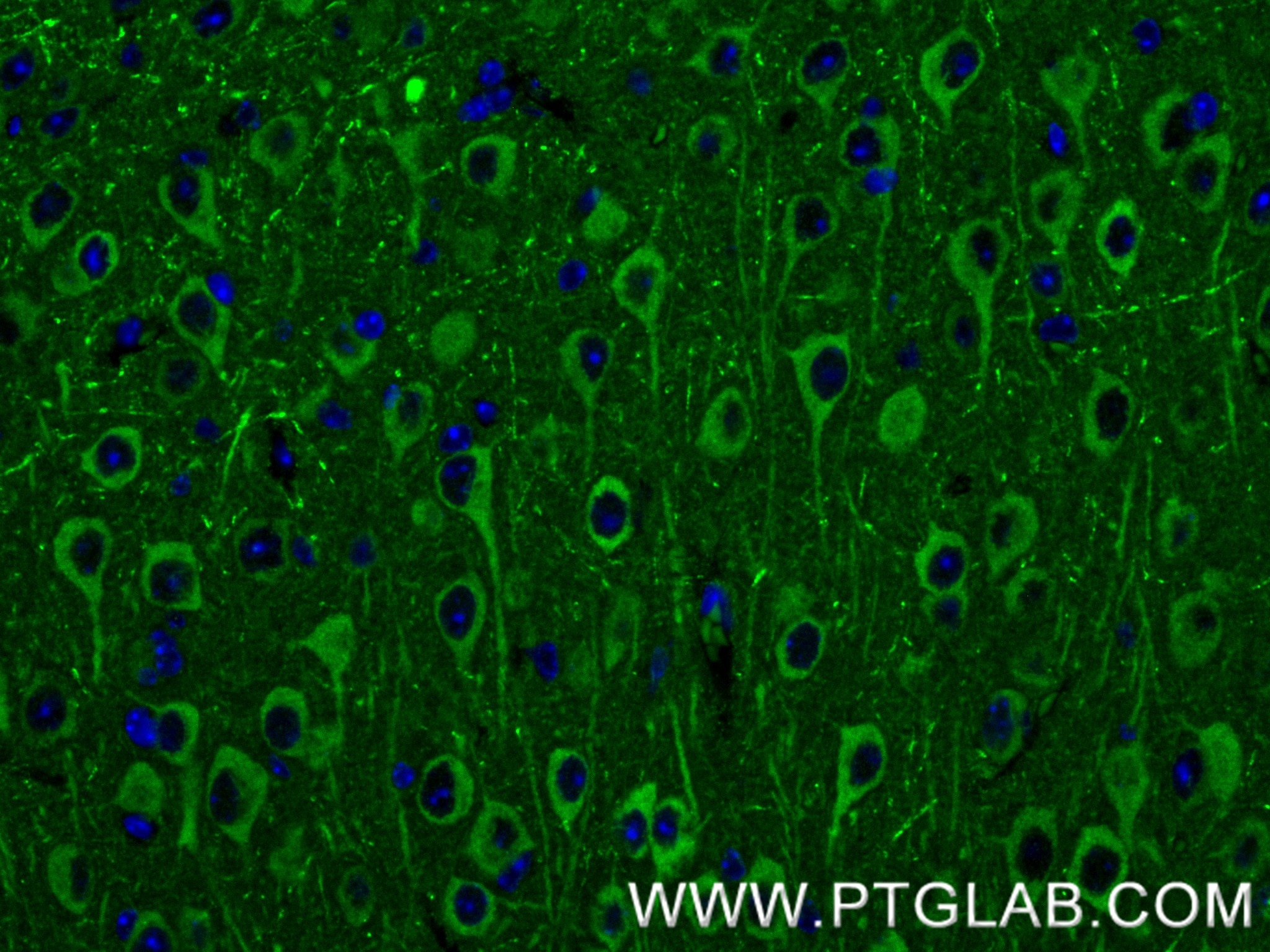Immunofluorescent analysis of (4% PFA) fixed paraffin-embedded mouse brain tissue using NCDN antibody (85730-1-RR, Clone: 243146E2 ) at dilution of 1:400 and CoraLite®488-Conjugated Goat Anti-Rabbit IgG(H+L) (SA00013-2). Heat mediated antigen retrieval with Tris-EDTA buffer (pH 9.0). Immunofluorescence (IF) / fluorescent staining of mouse brain tissue using NCDN Recombinant monoclonal antibody (85730-1-RR)