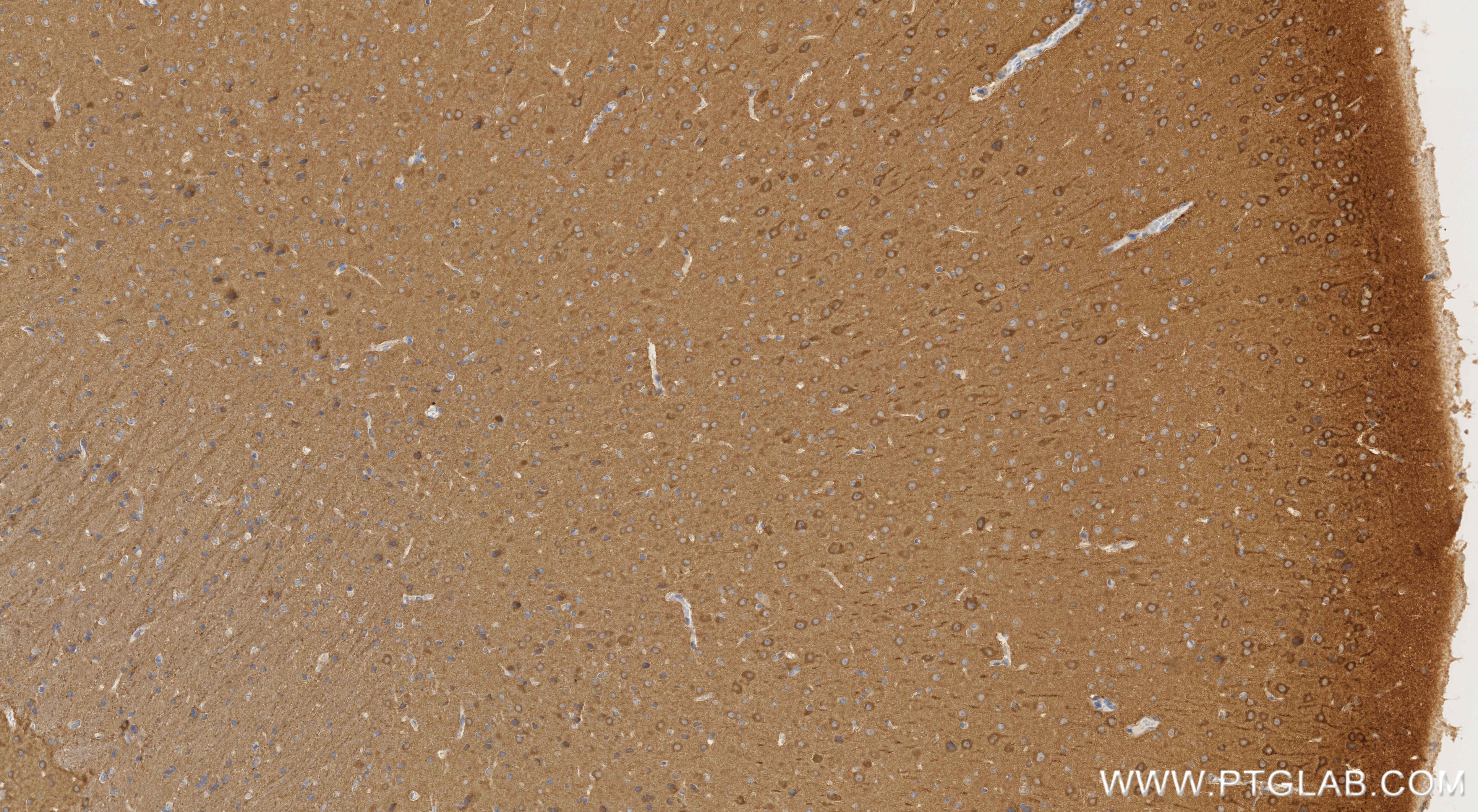 Immunohistochemistry (IHC) staining of mouse brain tissue using NCDN Recombinant monoclonal antibody (85730-1-RR)