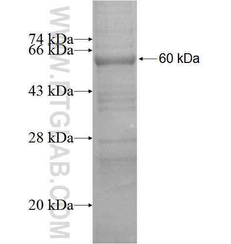 NCDN fusion protein Ag3859 SDS-PAGE